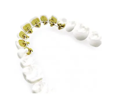 Hidden braces in Hidden braces in