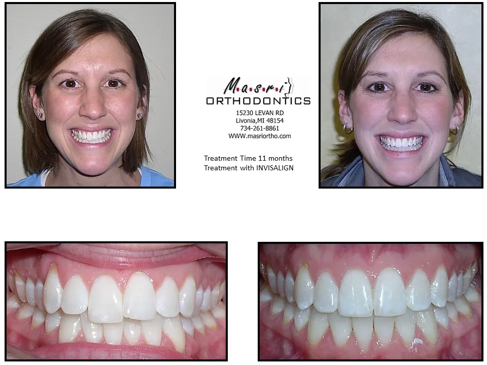 Before & After
