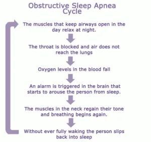 Sleep Apnea