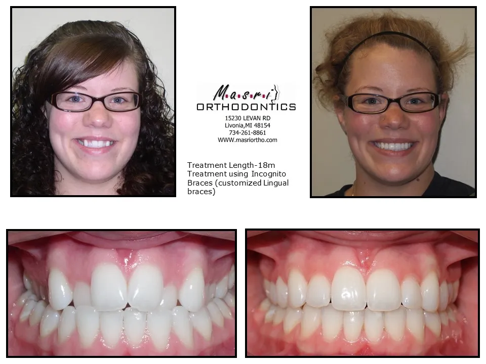 Before & After