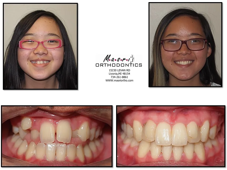 Before & After