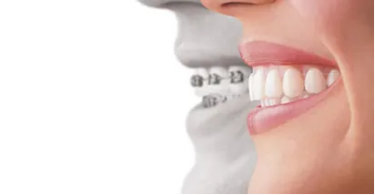 Masri Orthodontics img