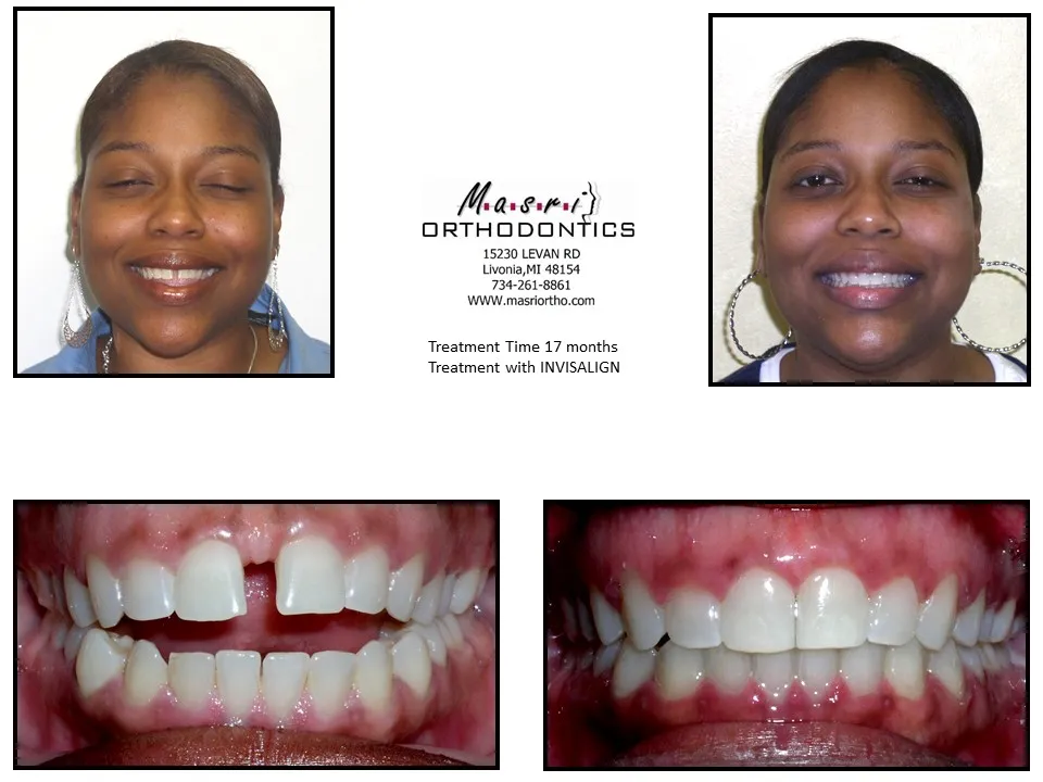 Before & After