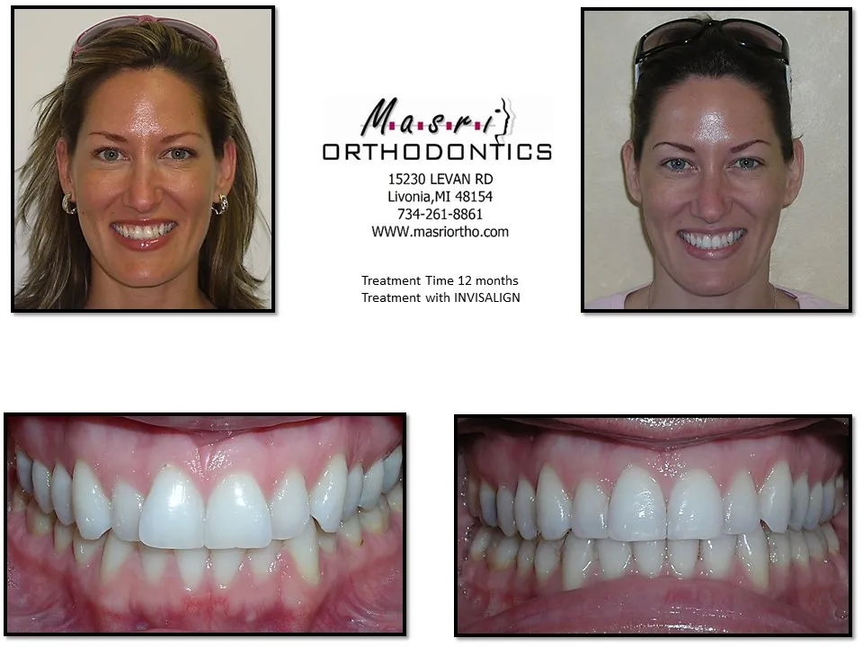 Before & After