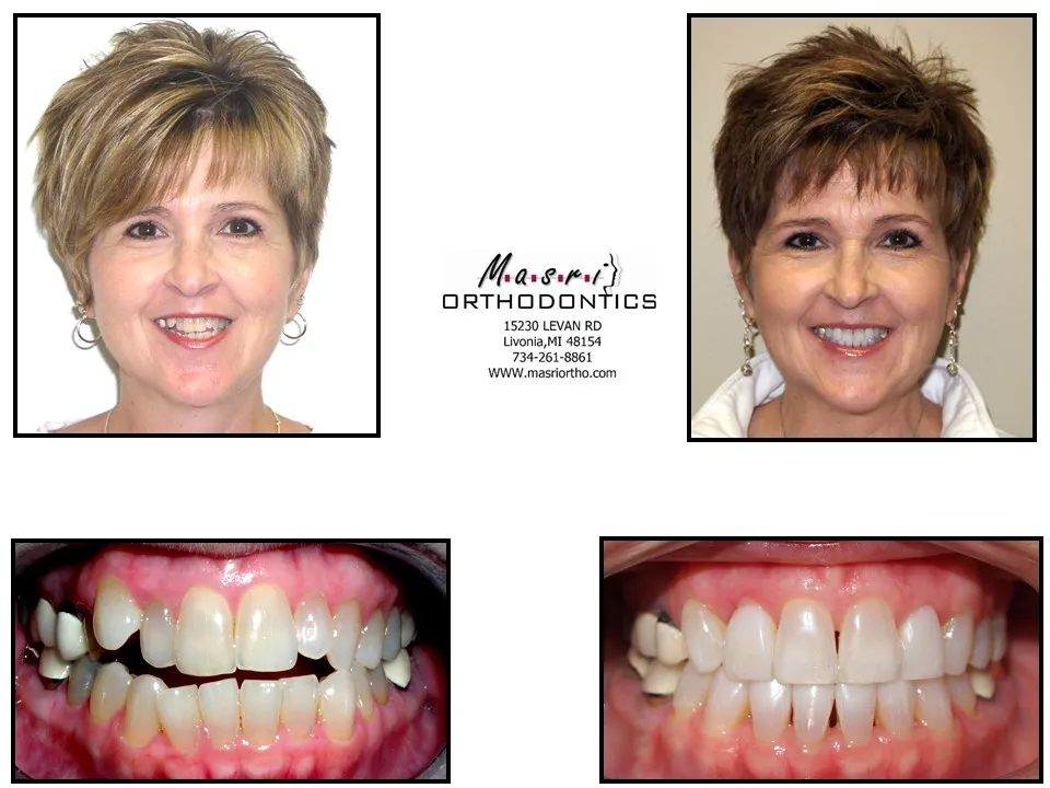 Before & After