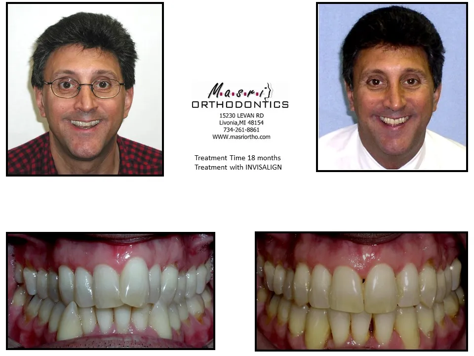 Before & After