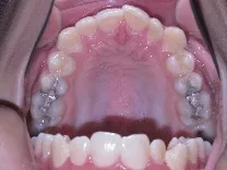 Teleorthodontics