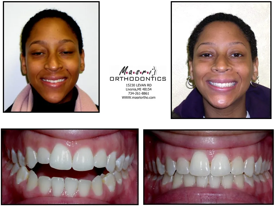 Before & After