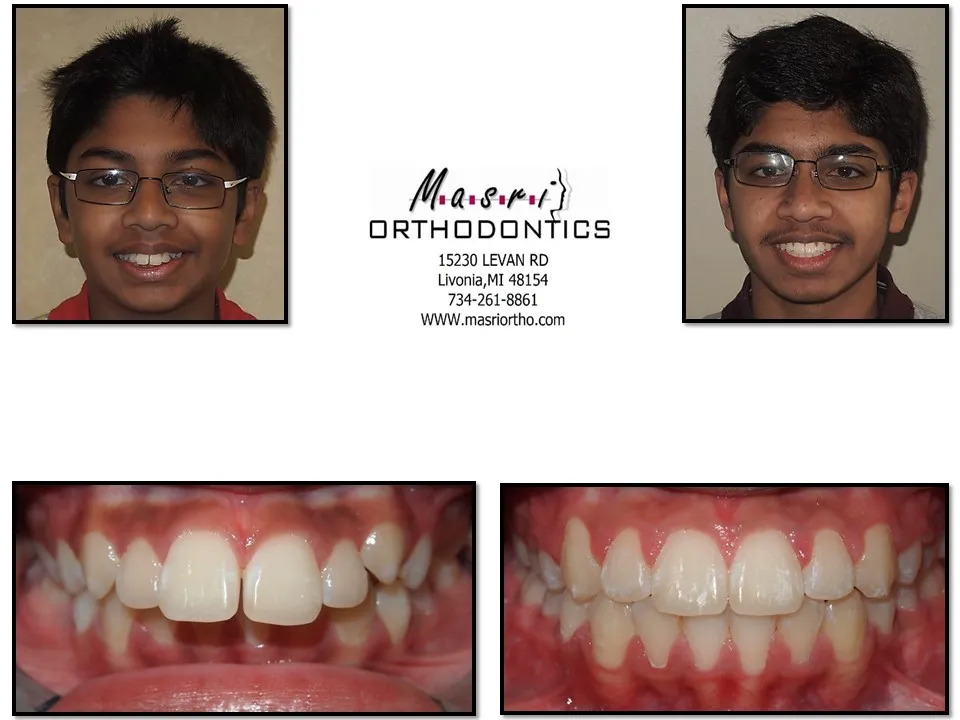 Before & After
