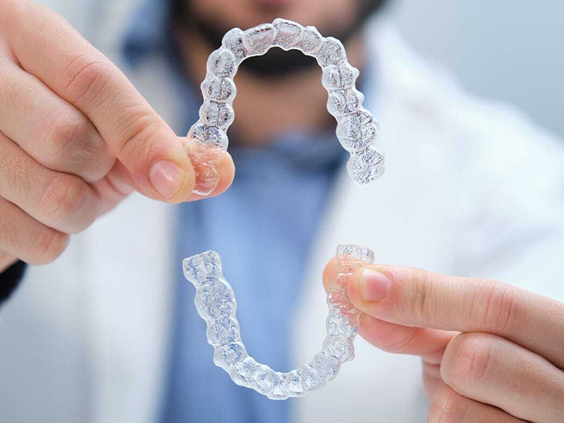 american aligners